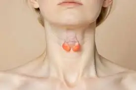Glándula tiroides expuesta en el cuello de una mujer